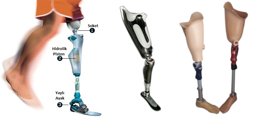 ortez-protezler ferqi hazirlanan